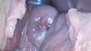 Milly17 cervix penetration and speculum порно реальный секс