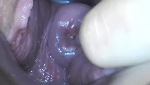 Milly17 cervix penetration and speculum порно реальный секс