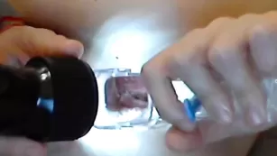 Bananaa игры с гинекологическими инструментами