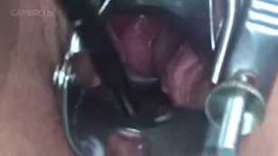 Lilithnox cervix sounding compilation | sounding, kink, fetish, gape, BBW